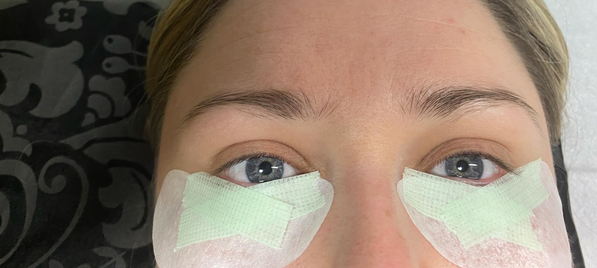 A lash lift in progress, with pads under the eyes